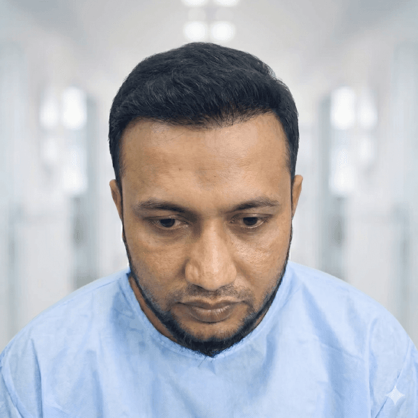 After skin rejuvenation treatment